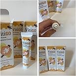 Bee Venom Vitigo Correcting Cream